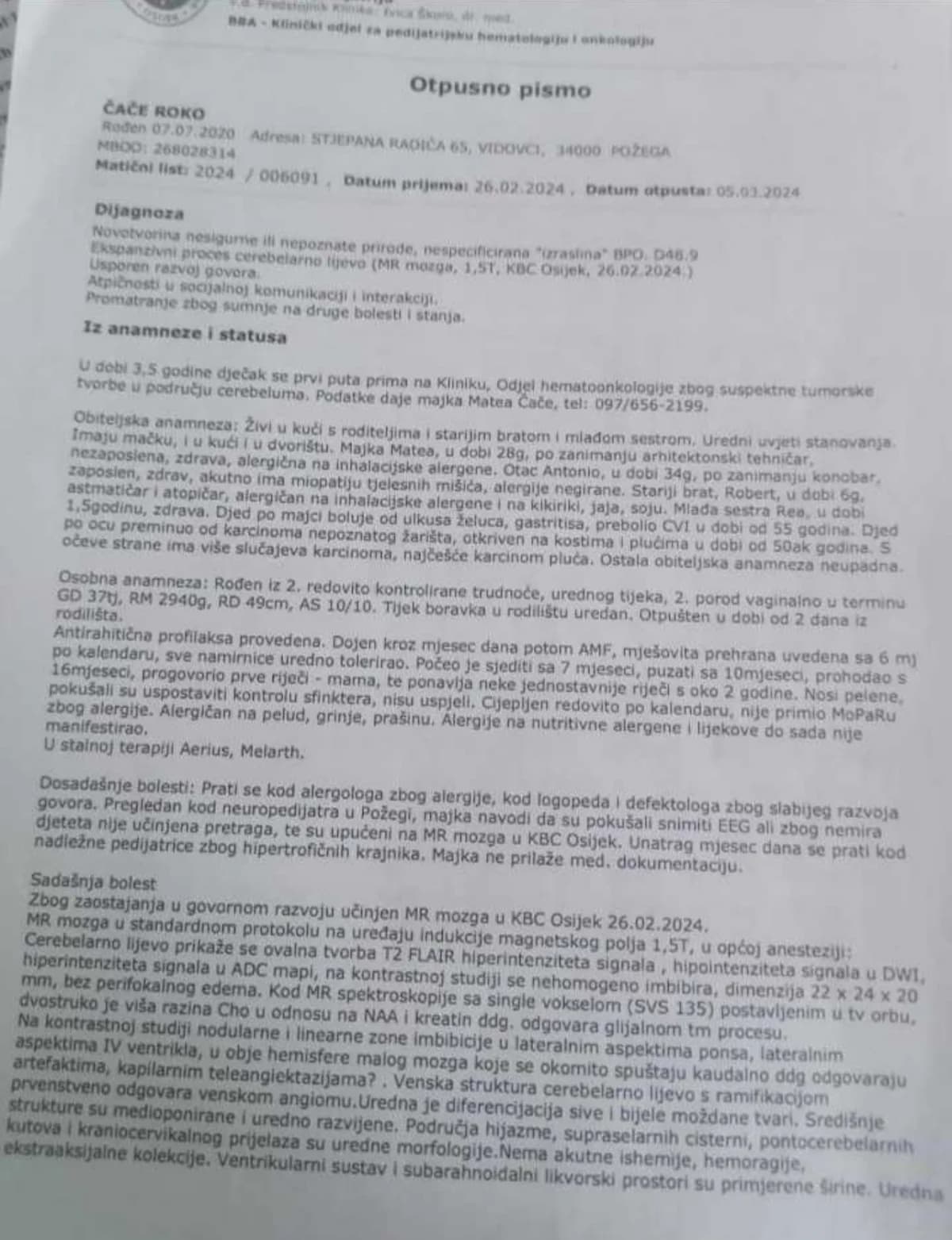 Požežani pomognite: Roko ima nepune četiri godine i tumor na mozgu!