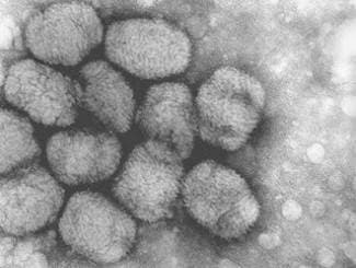Stvoren virus koji može uništiti pola svjetskog stanovništva