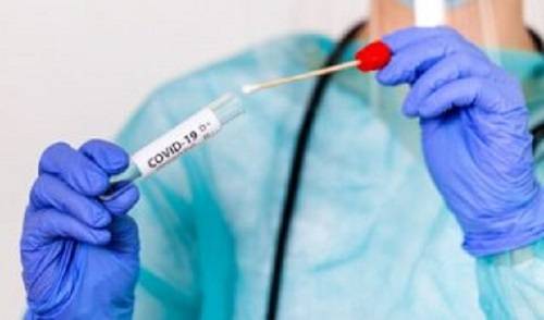 SB Online | HZZO će odsad brze antigenske testove plaćati po znatno nižoj cijeni