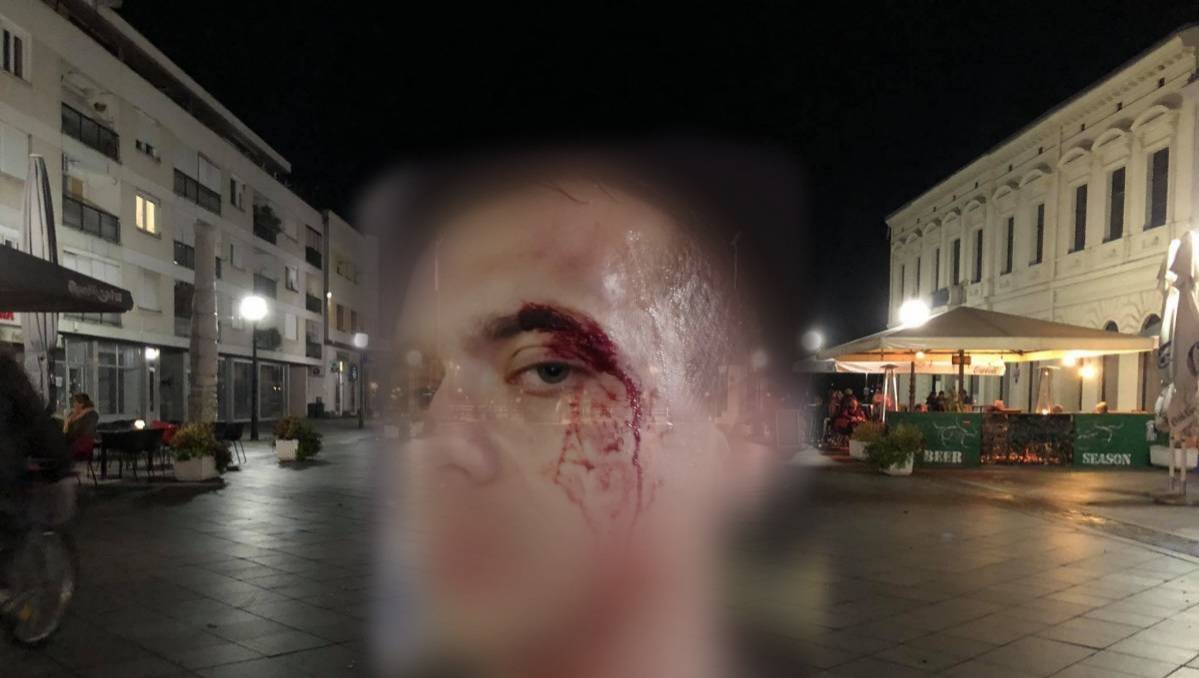 SB Online | UZNEMIRUJUĆE: Što se jutros dogodilo na Korzu? Policija radi na utvrđivanju činjenica 