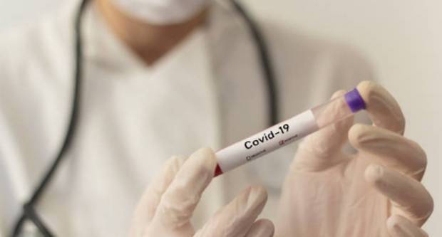 SB Online | 54 nova slučaja koronavirusa u posljednja 24 sata, u bolnicama ukupno 80 osoba