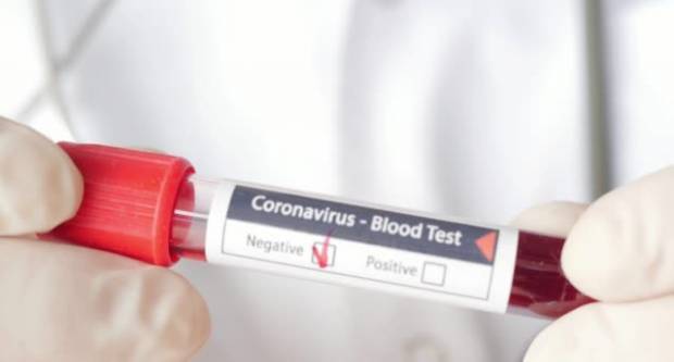 SB Online | U protekla 24 sata zabilježeno je 45 novih slučajeva zaraze korona virusom